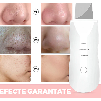 Aparat de curatare faciala cu ultrasunete 8815 indepartare puncte negre hidratare peeling masaj facial Aparat de curatare faciala cu ultrasunete 8815 indepartare puncte negre hidratare peeling masaj facial