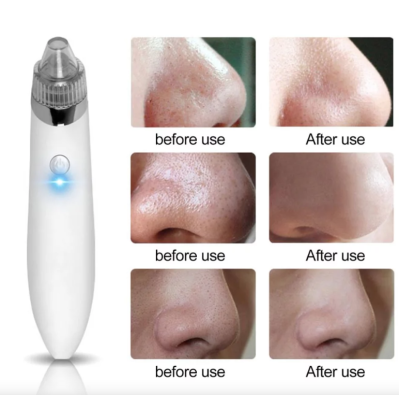 Aparat pentru curatarea tenului si porilor XN 8030