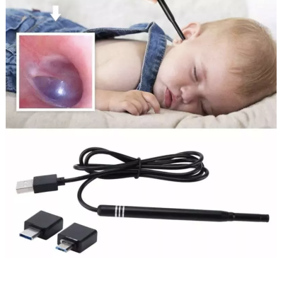 Camera Endoscopica Pentru Inspecite Ureche Nas Piele 6 LED Incarcare USB Cu Dipslay Inclus de 4 3 Inch