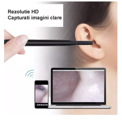 Camera Endoscopica Pentru Inspecite Ureche Nas Piele 6 LED Incarcare USB Cu Dipslay Inclus de 4 3 Inch