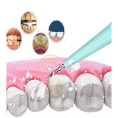 Dispozitiv electric pentru indepartarea depunerilor de tartru MD