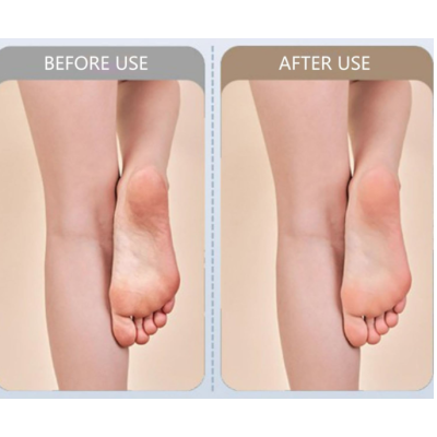 Pila electrica pentru calcai rotatie 360 Incarcare USB 2600 RPM