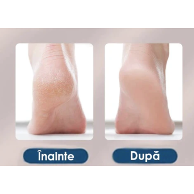 UB Pila electrica pentru curatare si ingrijire calcaie 