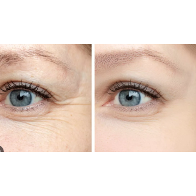 Rola masaj facial doua capete cu piatra ALBA