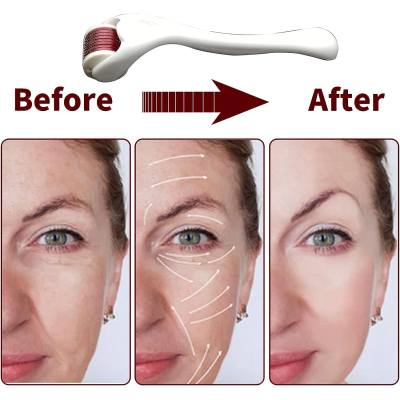 Rola masaj facial MESOROLLER 540ace 1mm  Alb