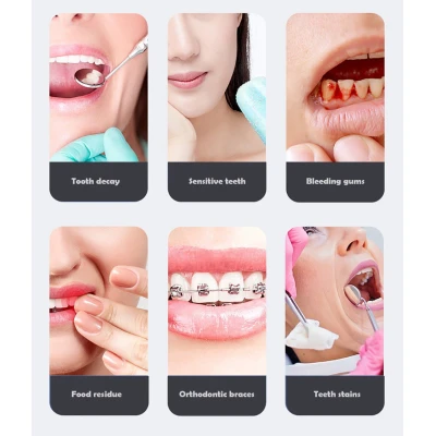Irigator oral reincarcabil C8