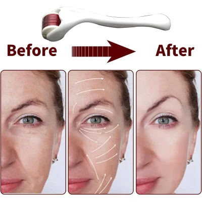 Rola masaj facial MESOROLLER 540ace 1mm  Alb