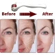 Rola masaj facial MESOROLLER 540ace 1mm  Alb