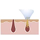 Aparat facial Derma Suction Curatitor ten cu vacum Aparat facial Derma Suction Curatitor ten cu vacum