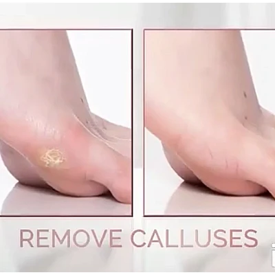 Pila pentru calcaie cu 2 capete Pila pentru calcaie cu 2 capete
