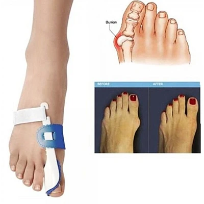 Suport pentru corectare monturi GoodNight BUNION Suport pentru corectare monturi GoodNight BUNION