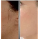 Epilator facial Hipolergenic pentru dama cu led NuBrilliance HAIRLESS Epilator facial Hipolergenic pentru dama cu led NuBrilliance HAIRLESS