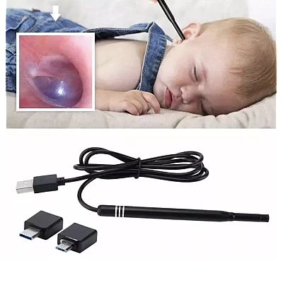 Camera Endoscopica Pentru Inspecite Ureche Nas Piele 6 LED Incarcare USB Cu Dipslay Inclus de 4 3 Inch Camera Endoscopica Pentru Inspecite Ureche Nas Piele 6 LED Incarcare USB Cu Dipslay Inclus de 4 3 Inch