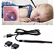 Camera Endoscopica Pentru Inspecite Ureche Nas Piele 6 LED Incarcare USB Cu Dipslay Inclus de 4 3 Inch Camera Endoscopica Pentru Inspecite Ureche Nas Piele 6 LED Incarcare USB Cu Dipslay Inclus de 4 3 Inch