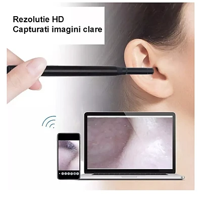Camera Endoscopica Pentru Inspecite Ureche Nas Piele 6 LED Incarcare USB Cu Dipslay Inclus de 4 3 Inch Camera Endoscopica Pentru Inspecite Ureche Nas Piele 6 LED Incarcare USB Cu Dipslay Inclus de 4 3 Inch