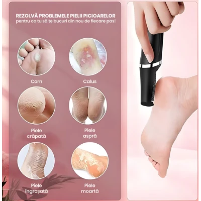 Pila electrica pentru calcaie si talpi reincarcabila cu aspirare 3 capete abrazive
