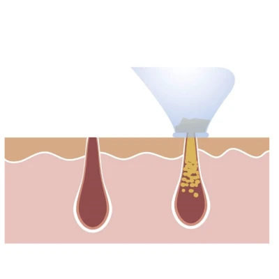 Aparat facial Derma Suction Curatitor ten cu vacum