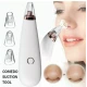 Aparat facial M-2005 MEANERSU pentru puncte negre