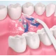 Irigator Bucal Portabil PPS Pulse ALB