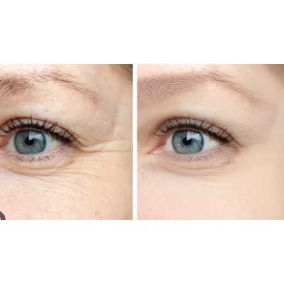 Rola masaj facial doua capete cu piatra ALBA